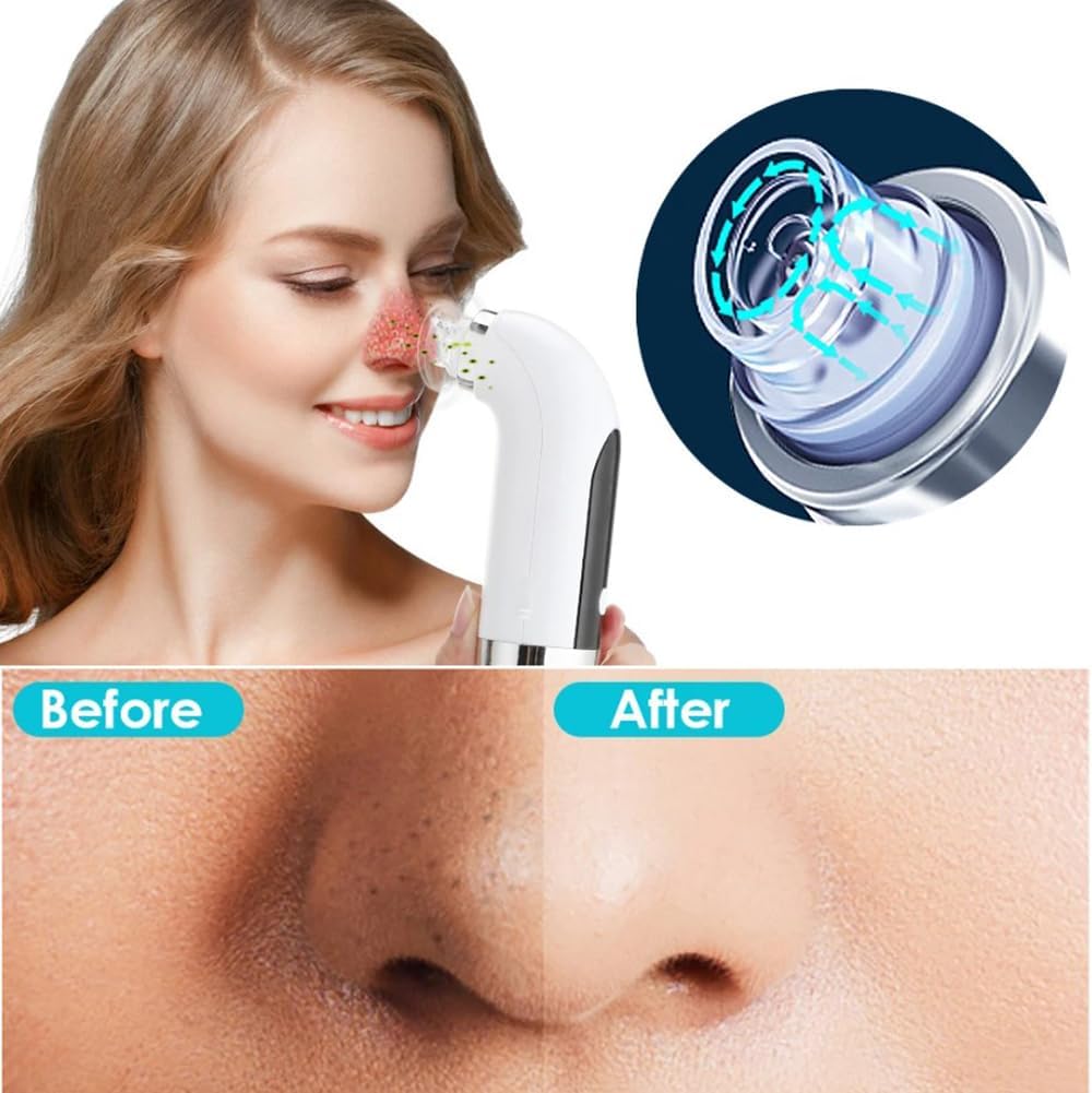 Limpiador Facial Tratamiento al Vacío
