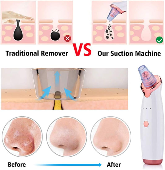 Limpiador de Puntos Negros