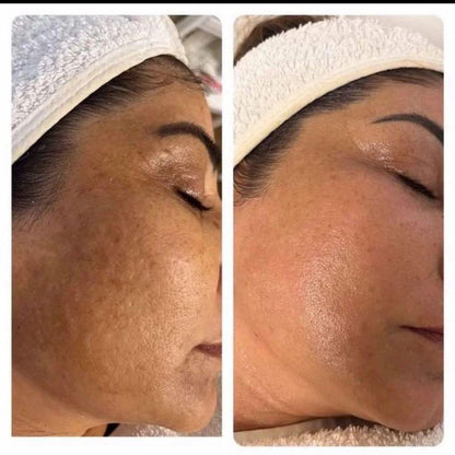 Crema Facial Iluminadora con Niacinamida 2,2% y Péptidos