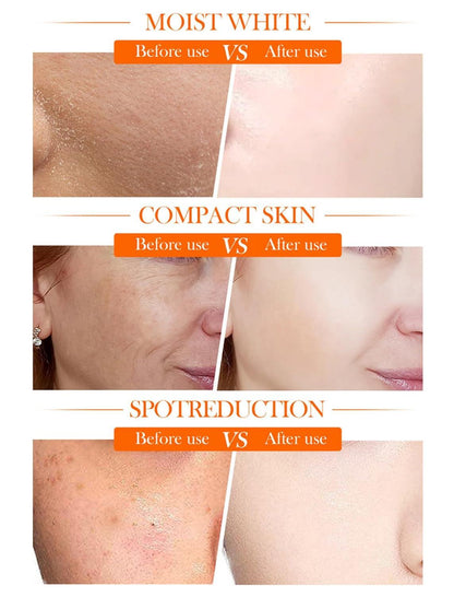 Crema Facial 5 en 1 con Vitamina C y Niacinamida – Efecto Glow Inmediato y Adiós Manchas