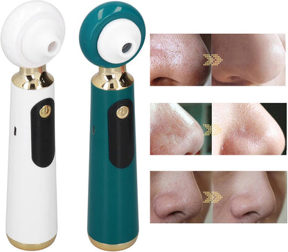 Aspiradora Recargable para Eliminar Puntos Negros Profundos con Lupa - innovagizmo.com