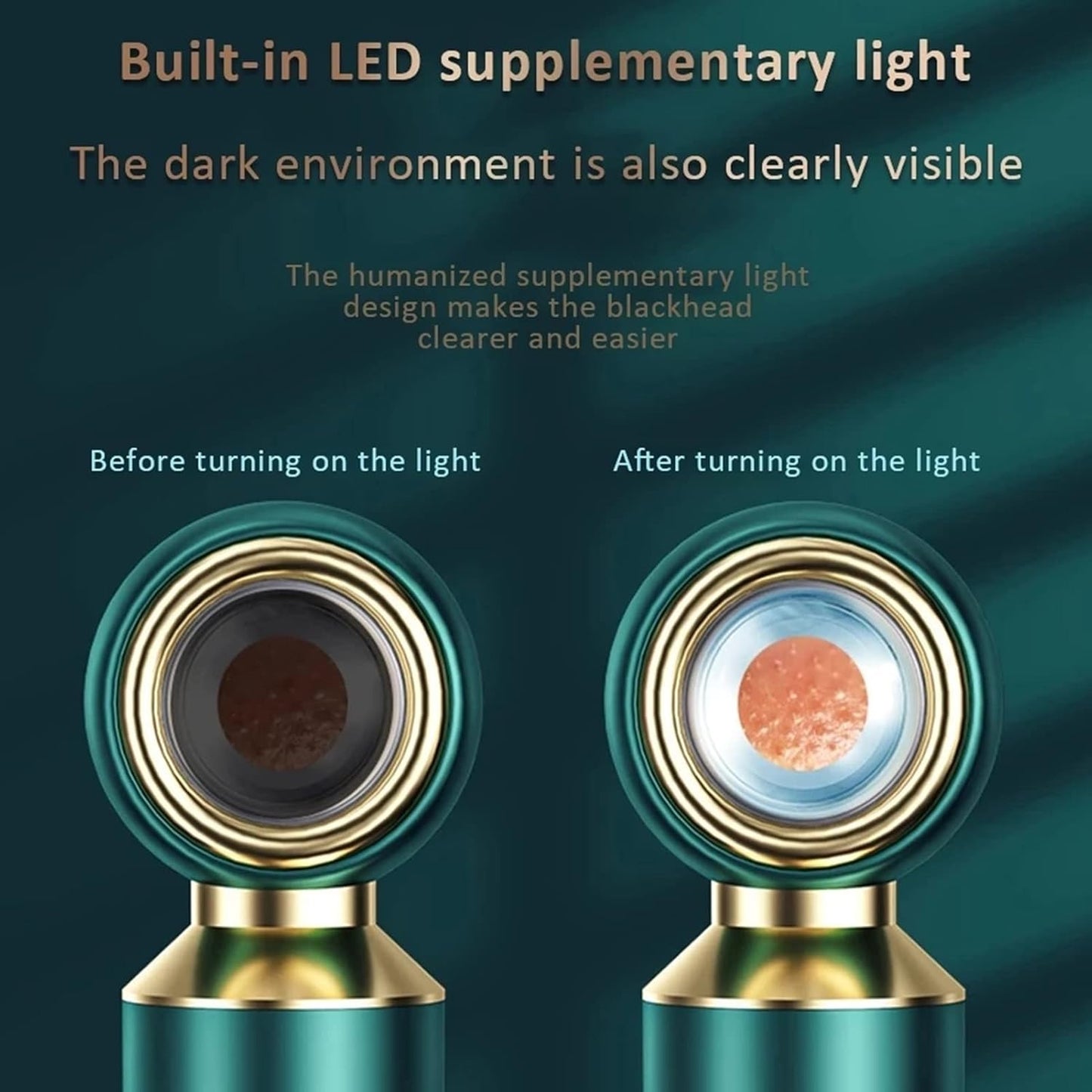 Aspiradora Recargable para Eliminar Puntos Negros Profundos con Lupa - innovagizmo.com