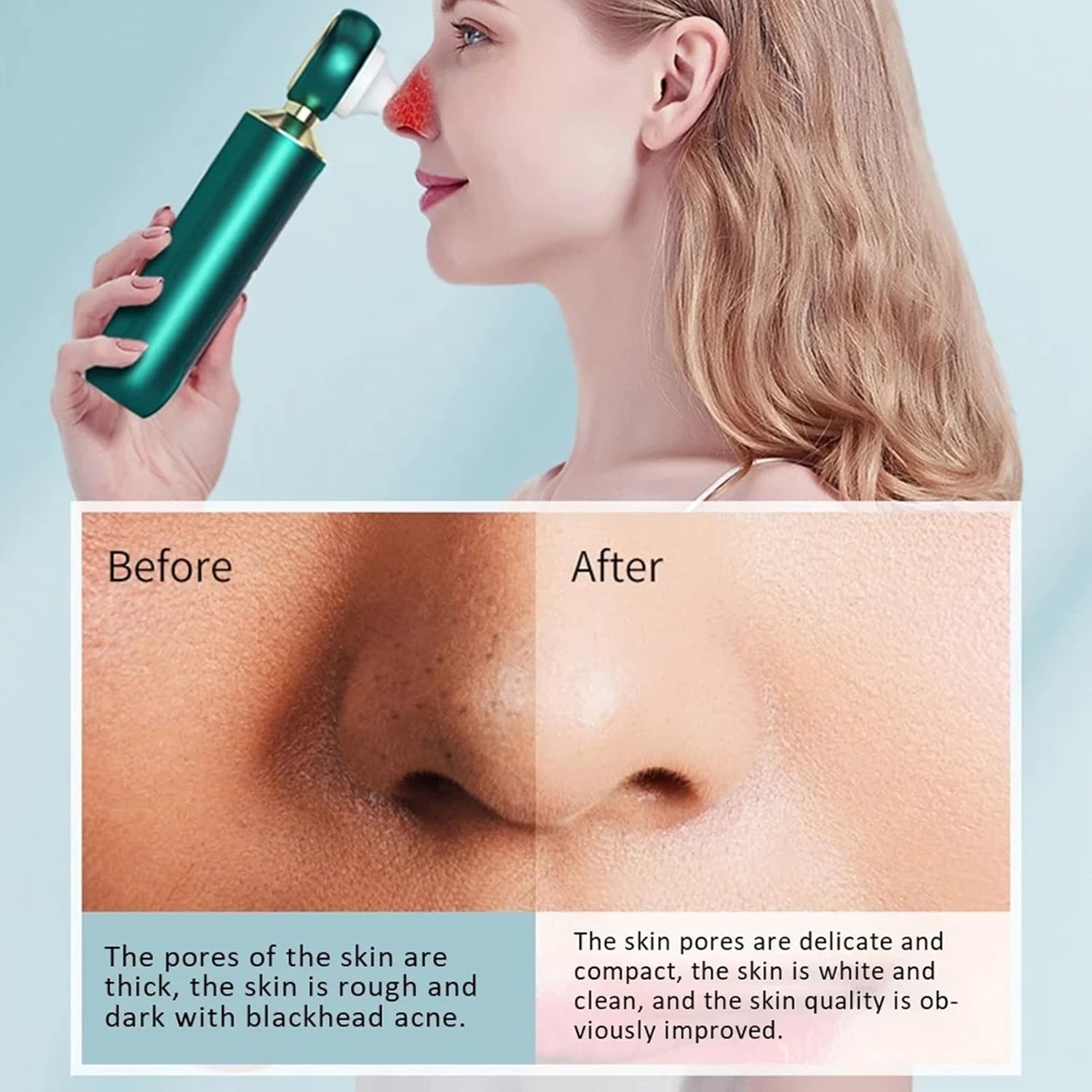 Aspiradora Recargable para Eliminar Puntos Negros Profundos con Lupa - innovagizmo.com