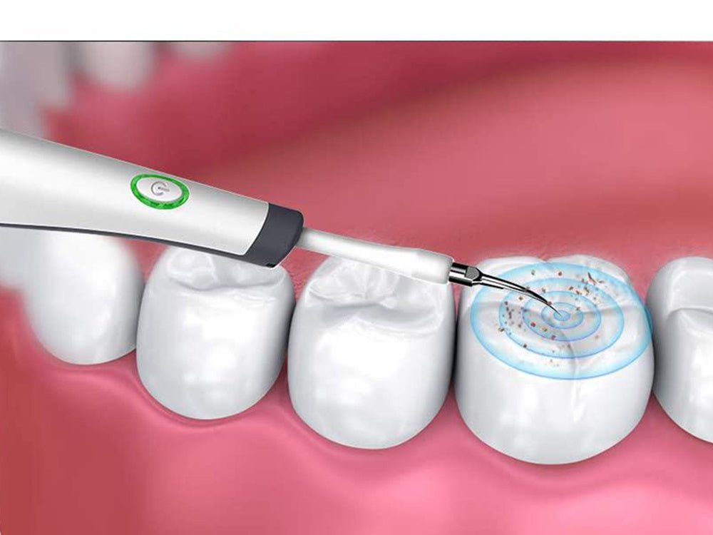 Cepillo Ultrasonico Dental - innovagizmo.com