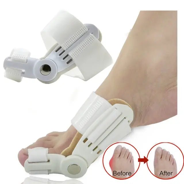 Corrector de hallux valgus infantil - innovagizmo.com