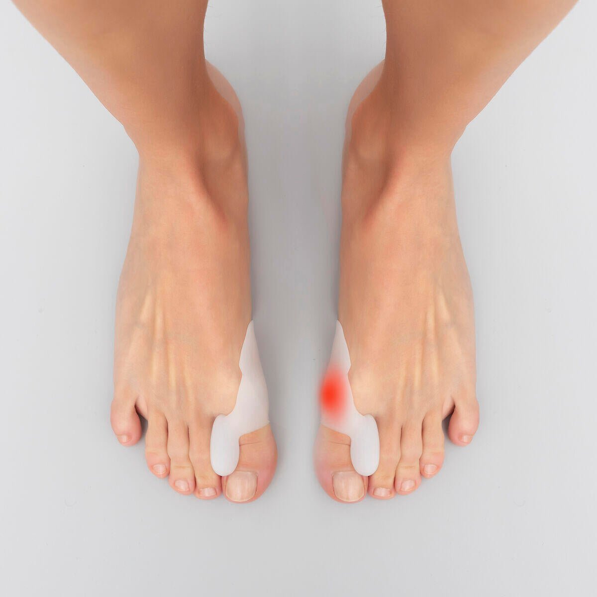 Corrector Protector de Silicona para Juanetes Bunilief InnovaGoods 2 Unidades - innovagizmo.com