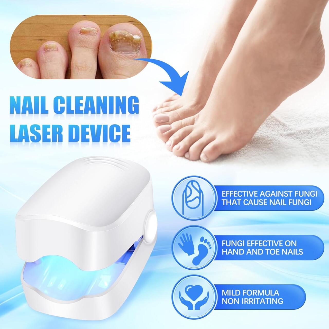 Dispositivo Láser para Tratamiento de Hongos Uñas - innovagizmo.com