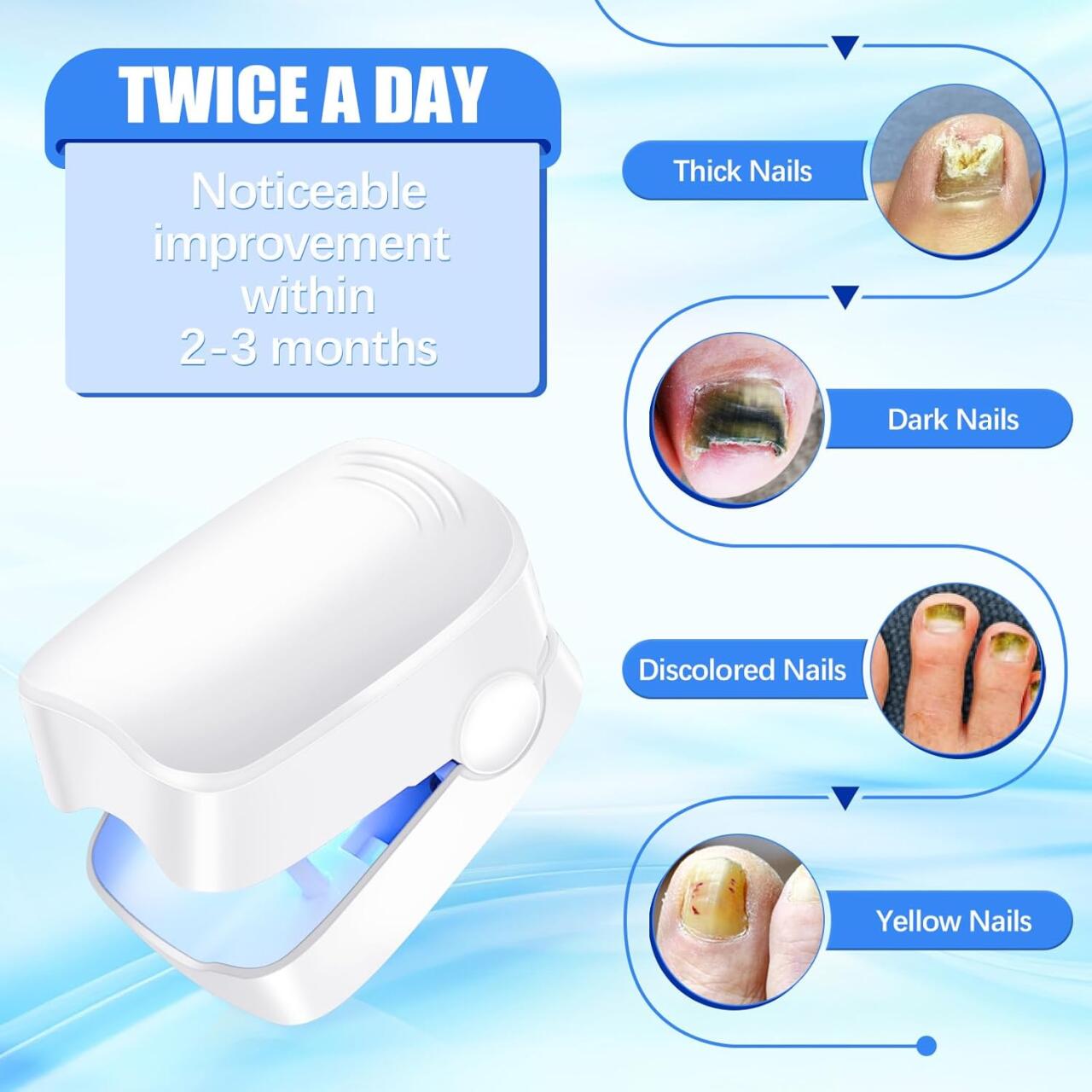 Dispositivo Láser para Tratamiento de Hongos Uñas - innovagizmo.com