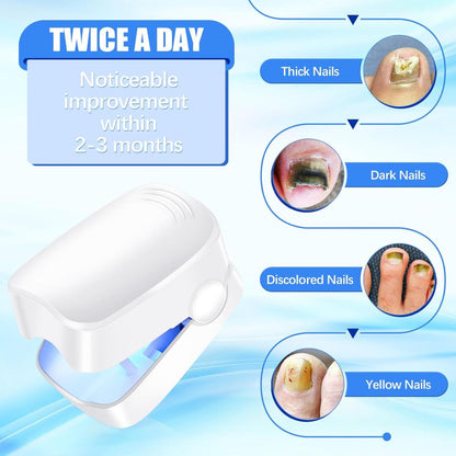 Dispositivo Láser para Tratamiento de Hongos Uñas - innovagizmo.com