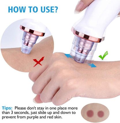 Limpiador de Puntos Negros - innovagizmo.com