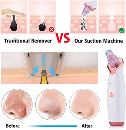 Limpiador de Puntos Negros - innovagizmo.com