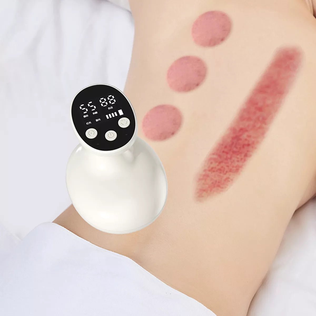 Masajeador Anticelulítico Recargable con Succión y Calor – Remodela Tu Cuerpo - innovagizmo.com