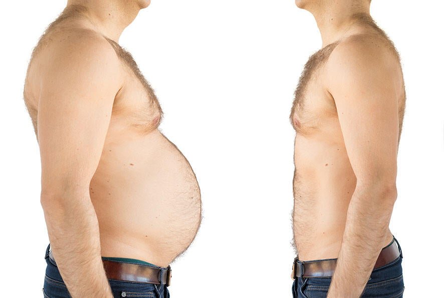 RXB Super Fat Reducer: Transforma tu Cuerpo de Forma Natural y Rápida