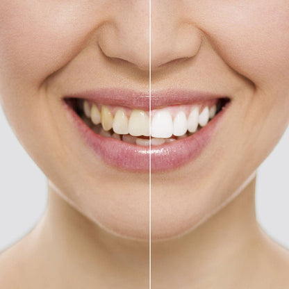 Tiras Blanqueadoras Dentales Wripes InnovaGoods - innovagizmo.com